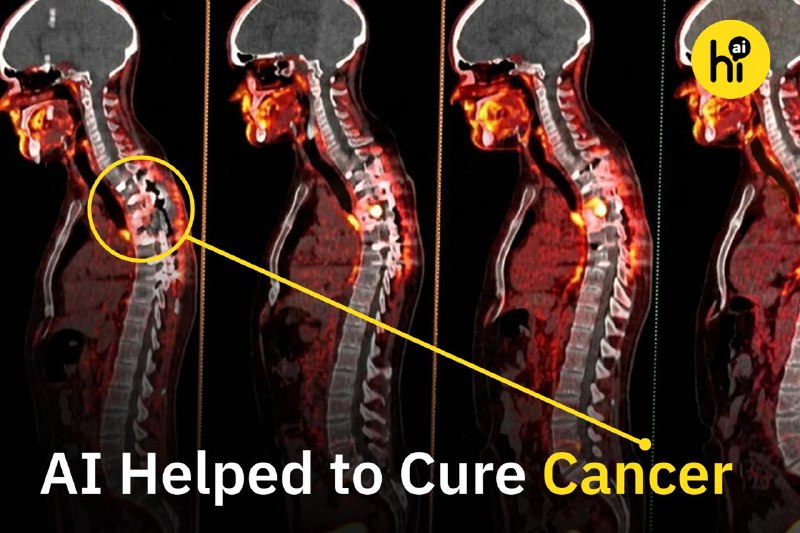 Innovative AI Approach Leads to Cancer Recovery for Patient After Traditional Treatments Fail